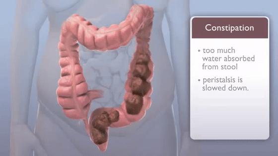 肛门痔瘘怎么治疗,肛肠疾病视频讲解