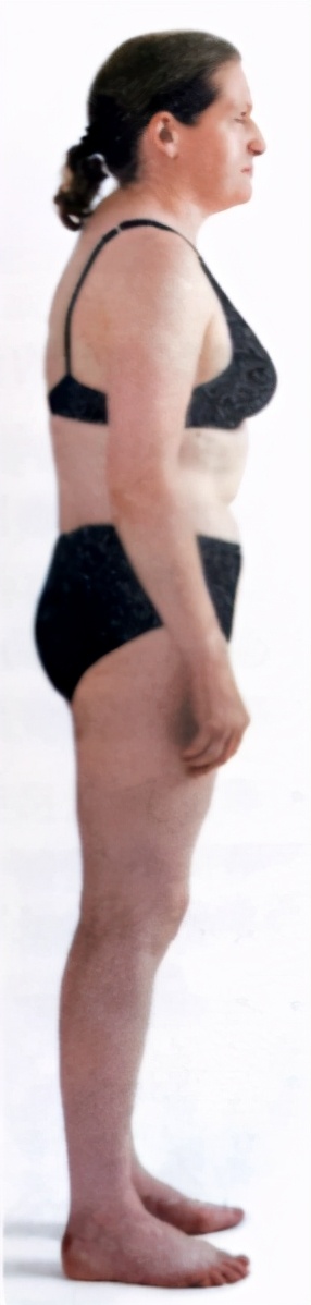 腰变直要怎样矫正,能让腰变直的几个动作