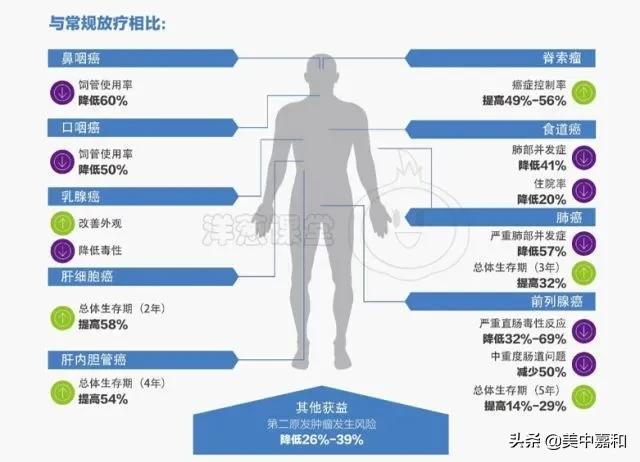 旋转束质子肿瘤放射治疗系统,肿瘤放射治疗
