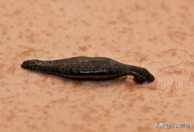 身体误吞蚂蝗，会在体内繁殖吗？被吸血了别慌，这么做