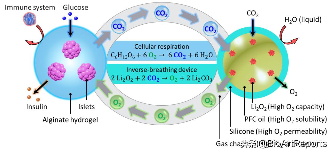 一劳永逸胰腺移植技术治疗糖尿病,胰腺移植治糖尿病的功效