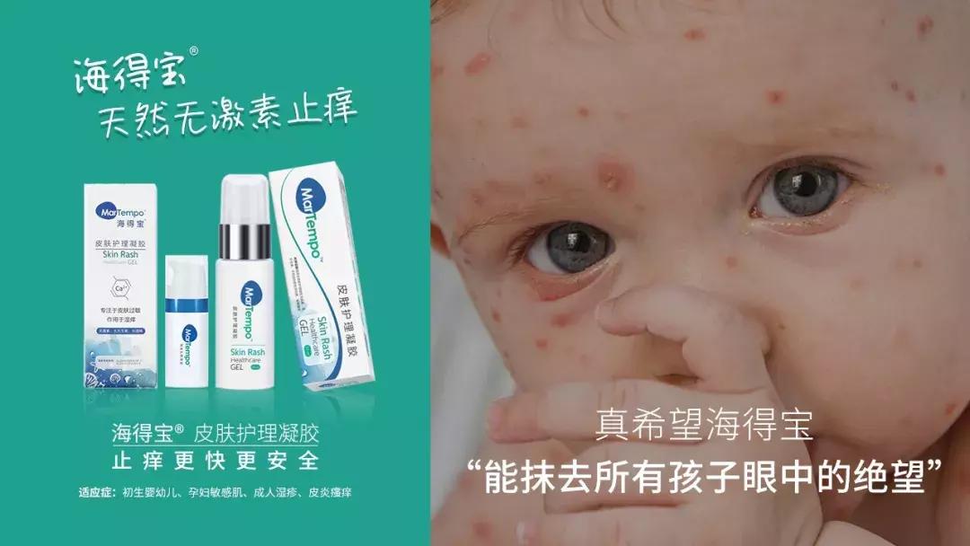 海得宝治疗什么,海得宝有没有激素