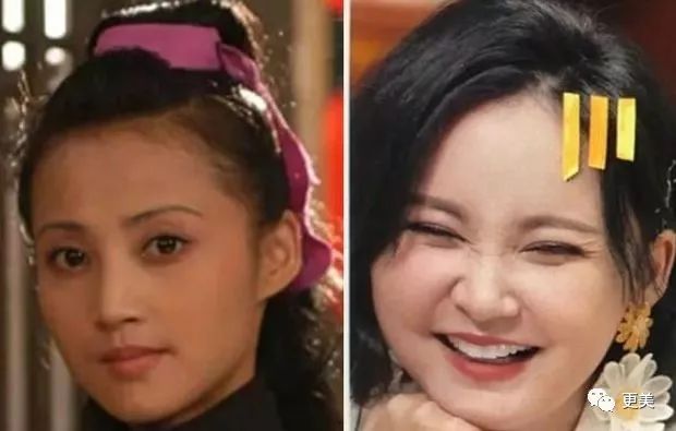 15天暴瘦20斤,却意外暴露了她填充过度的馒头脸