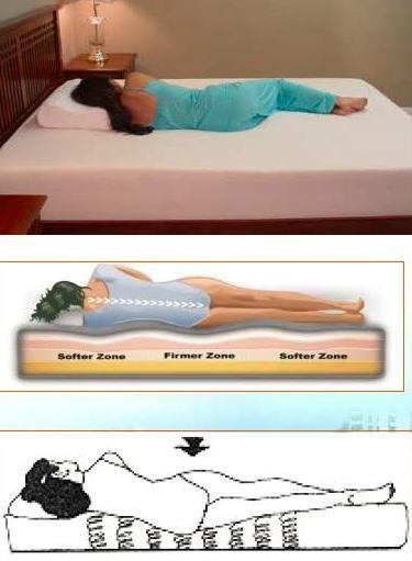 腰椎间盘突出针灸有副作用吗,腰椎间盘突出针灸越来越严重