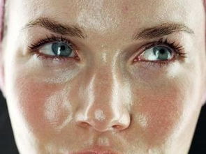 油肌如何控油,哪些简易方法有助于肌肤控油