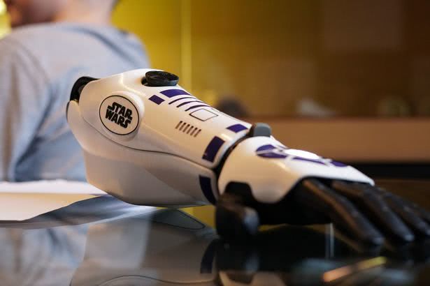 没有双臂的美国男孩获得假肢,失去双臂男孩考上剑桥大学