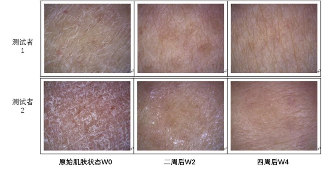 养生堂治疗皮肤痒,养生堂治疗皮肤瘙痒的偏方