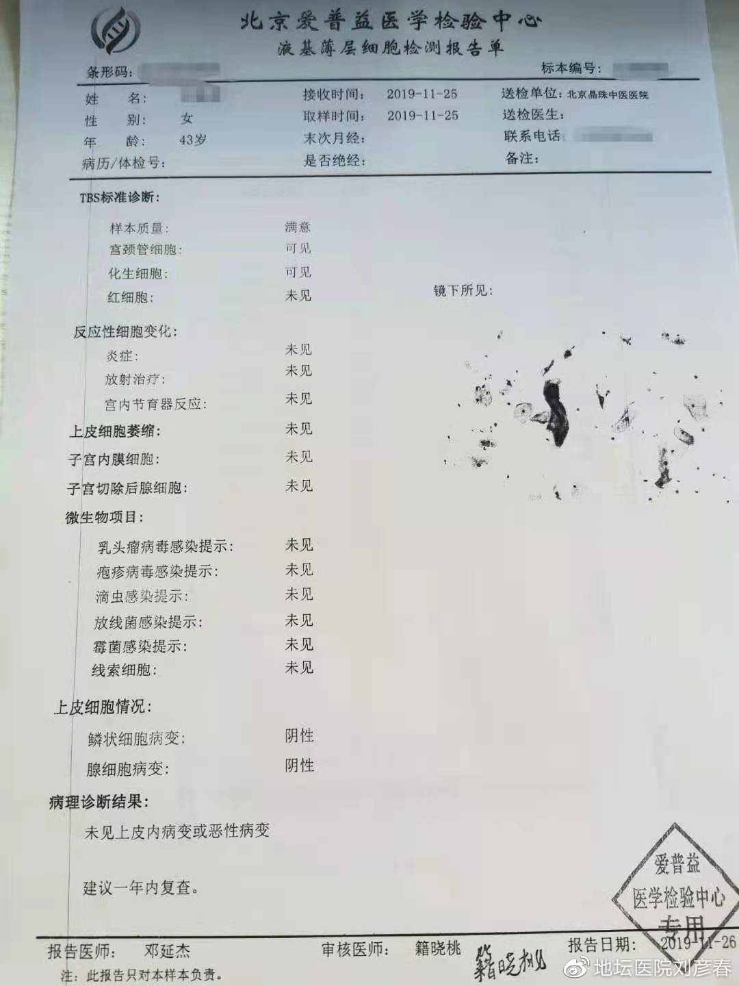 外阴及肛周瘙痒是感染hpv病毒吗,hpv感染外阴瘙痒腰骶酸痛是癌吗