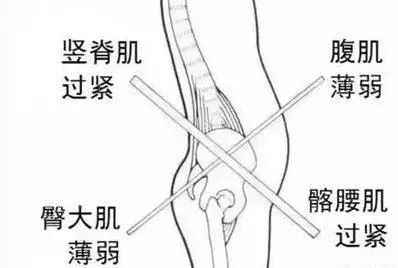 肾虚引发的腰疼是哪种,肾虚腰疼治疗法