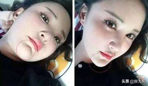 透明质酸和玻尿酸有什么区别,透明质酸跟玻尿酸是一个东西吗