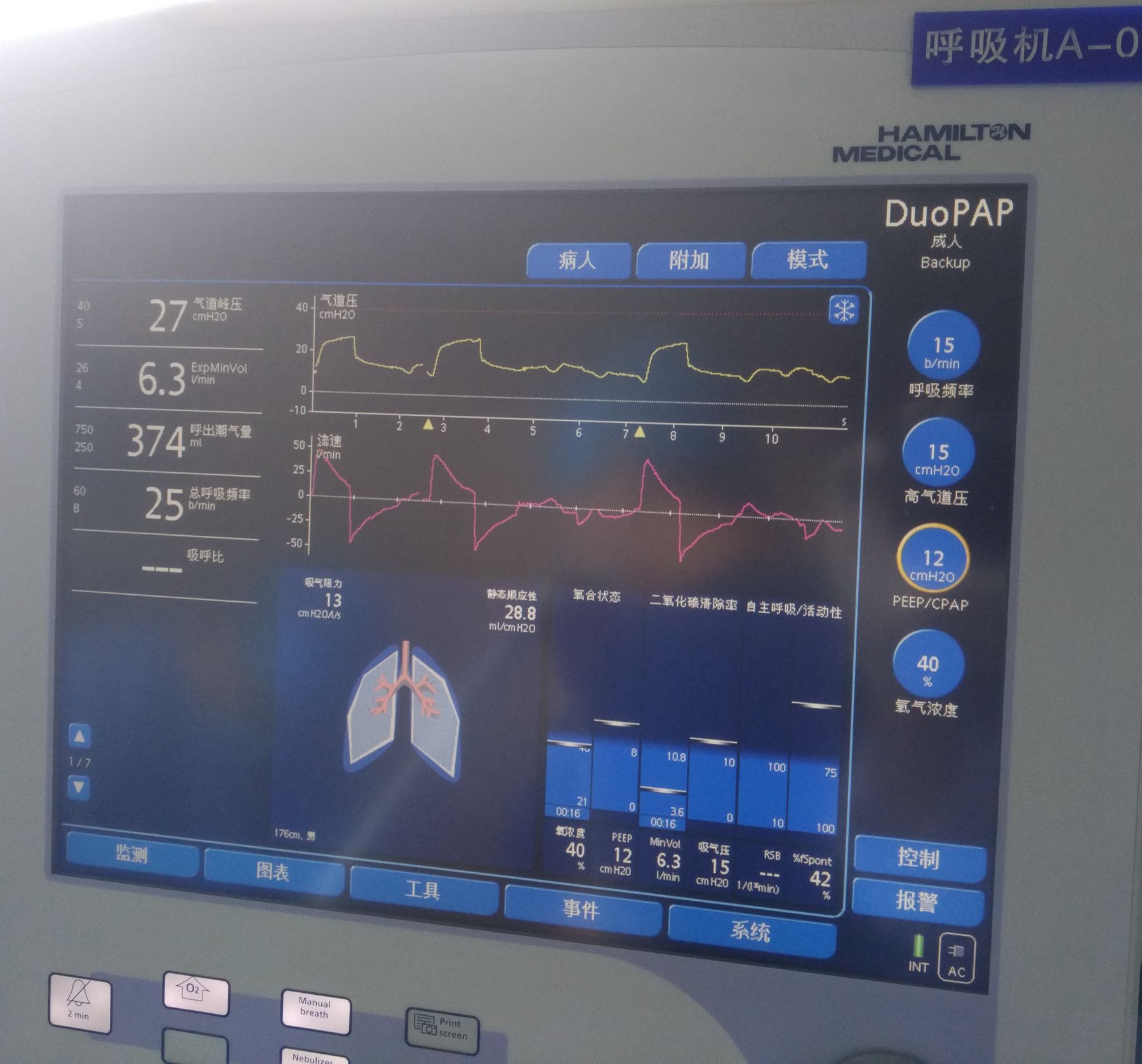 icu一般费用靠呼吸机维持该放弃吗,icu的呼吸机什么样子