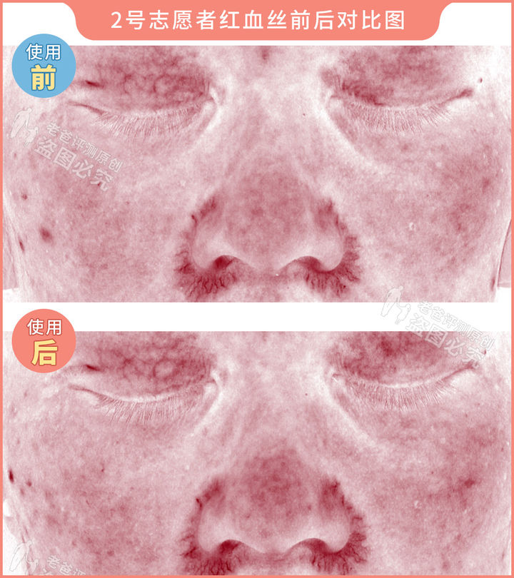 测评家用美容仪真的有用吗,网红推荐的美容仪有用吗