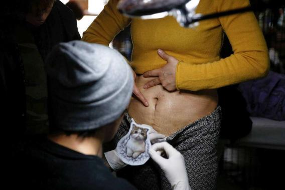 剖腹产5年了还能顺产吗,五年剖腹产三次危险吗