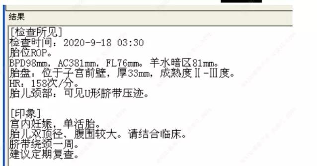 准妈妈如何克服生产时的恐惧心理,准妈妈的技巧和方法