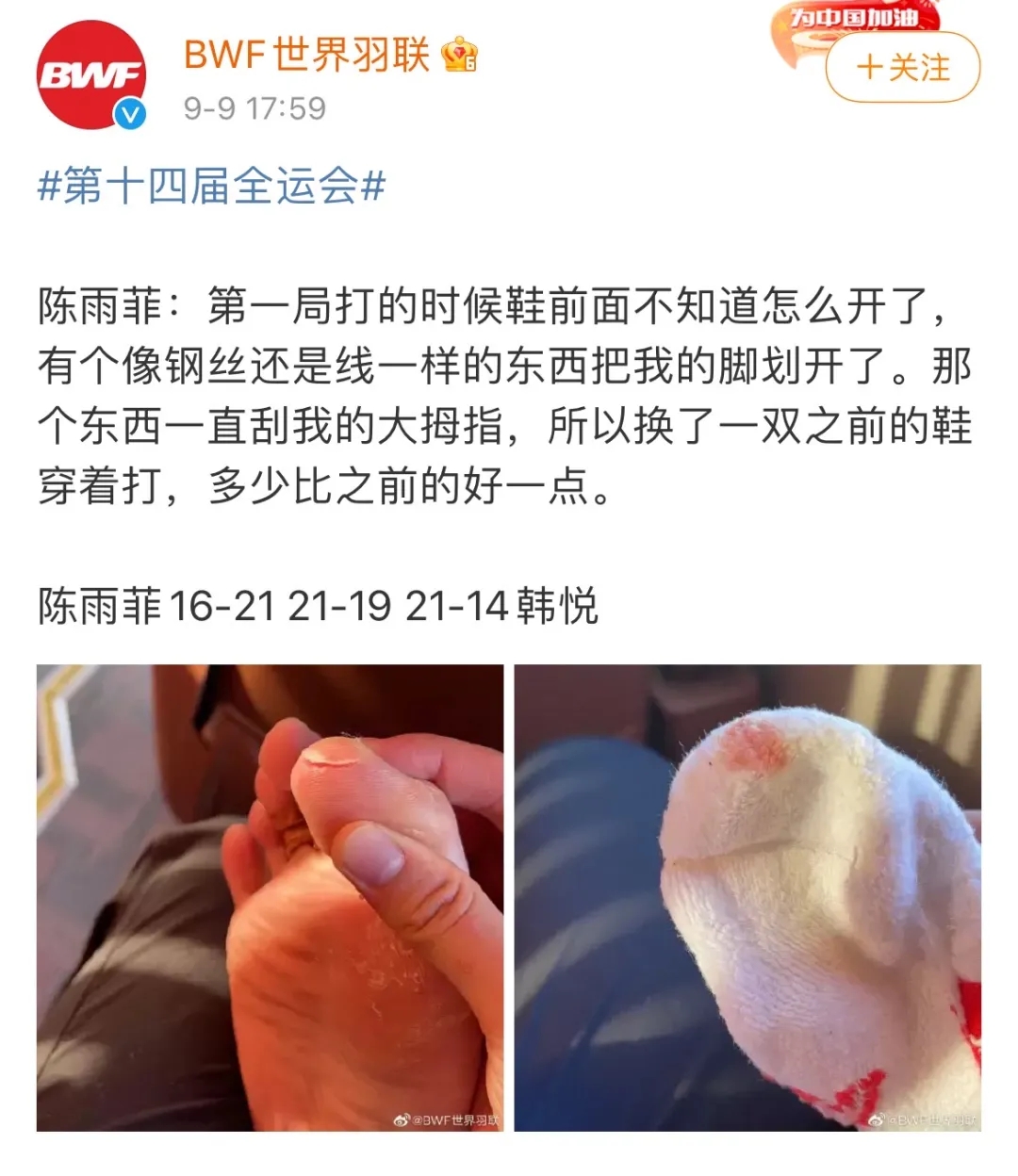 李宁质量问题给不给退货,李宁质量问题如何处理