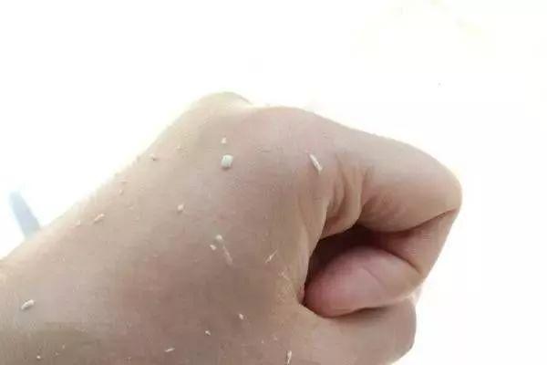 护肤品粘稠怎么补救,护肤品粘粘的怎么办