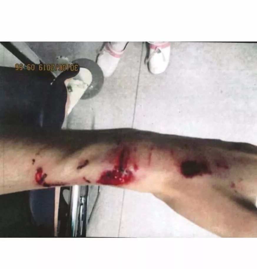 rocky指控,rocky最终判决结果