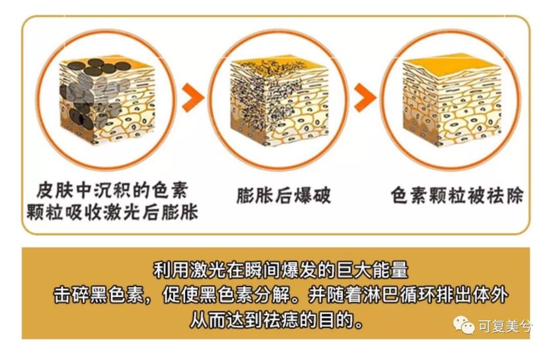 整形医院薅羊毛,整形医院的获客之道