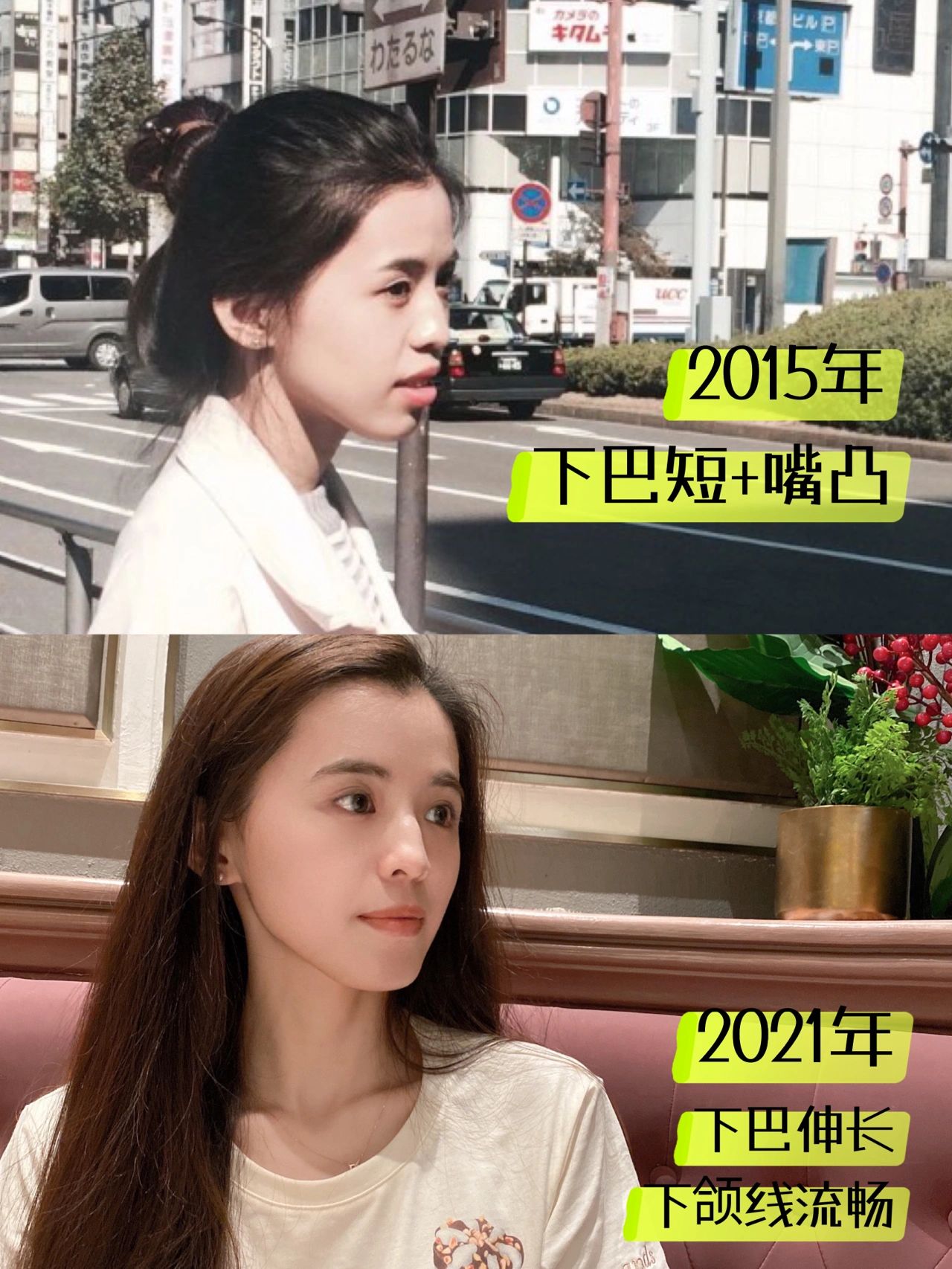 整牙分享,分享自己整牙过程怎么赚钱