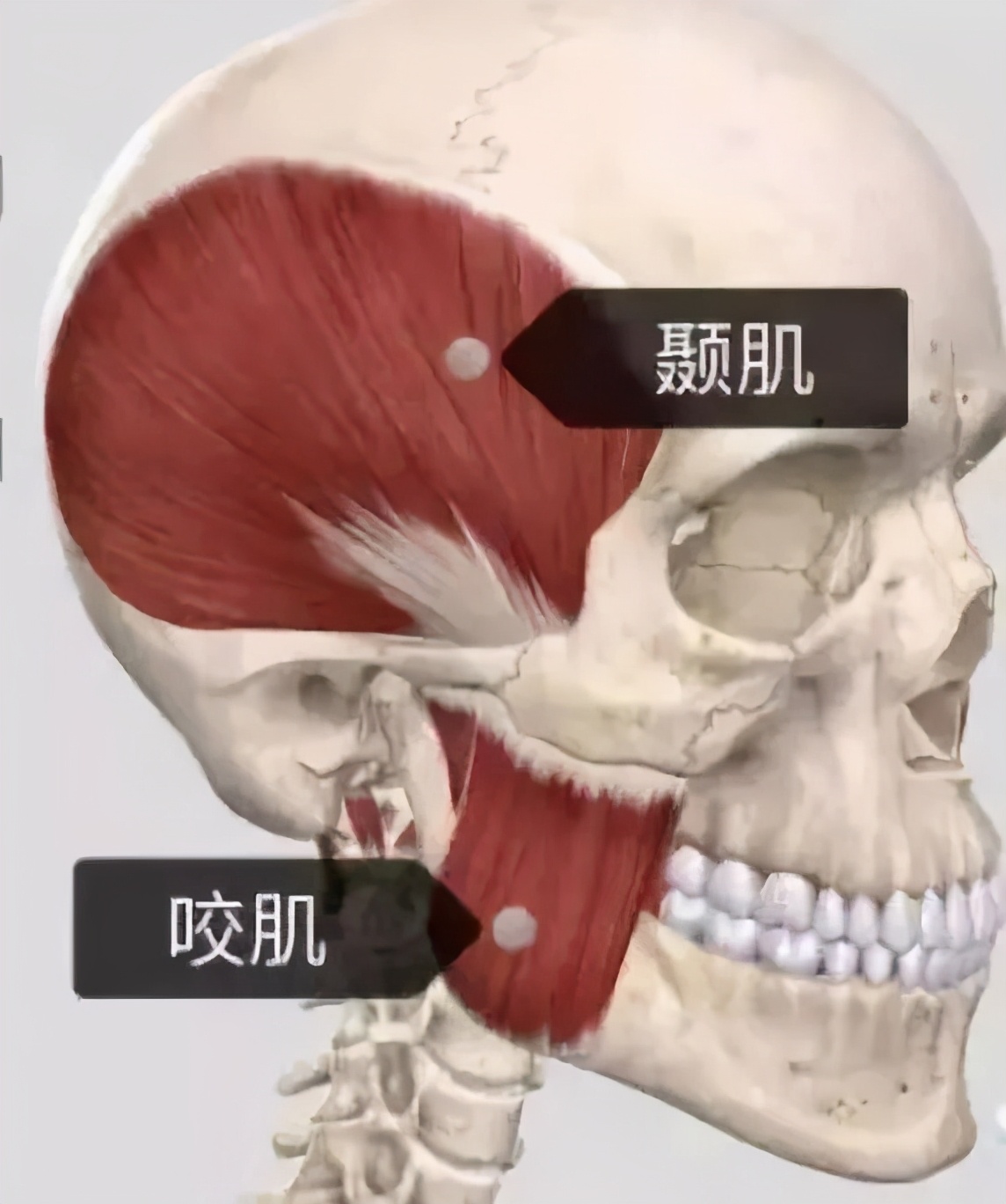 高颧骨脸型怎么变好看,脸型凹陷颧骨突出怎么矫正