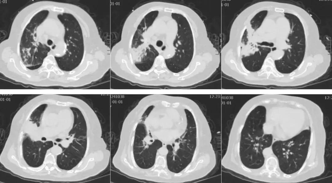 为什么说这个「古老」工具或许应重归呼吸医生的视野?