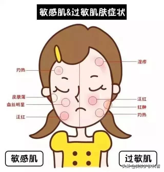 皮肤过敏长红疹用什么药,皮肤过敏长痘看什么科