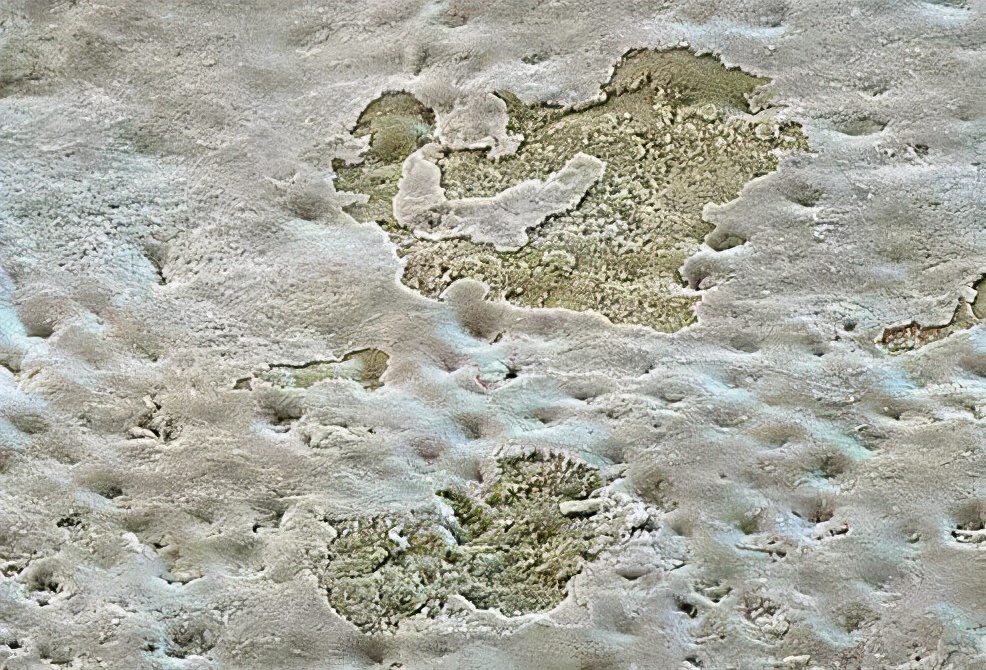 牙齿掉渣怎么处理,牙齿内部掉渣怎么治疗