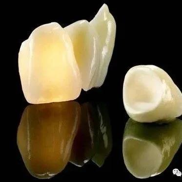 琚墮鍖诲拷鎮犲仛浜嗗叏鐡风墮瀵艰嚧鍢村嚫,鎻鐗欏尰璇寸殑鍏ㄧ摲鐗欏埌搴曟湁澶氬ソ