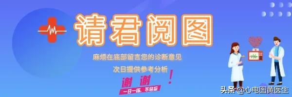 心房扑动是什么意思,心房扑动有什么症状