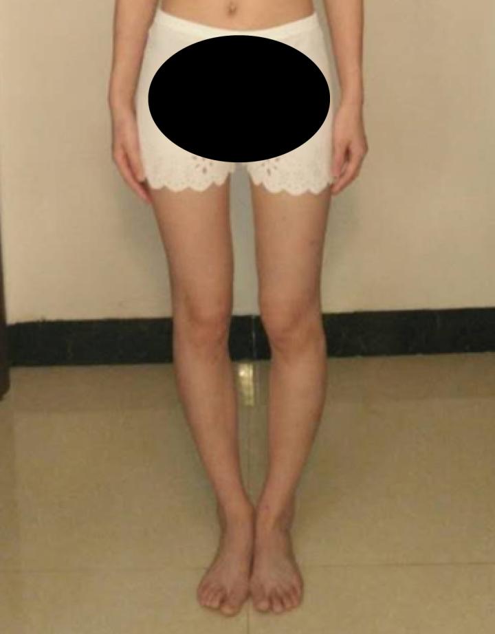 q角评估,q角指标详解图解