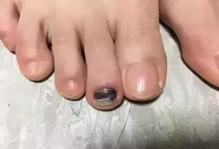 马拉松跑步袜子,跑马拉松能不能穿两双袜子