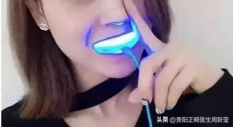 市面上冷光美牙仪真的有用吗,蓝光美白牙仪真的管用吗