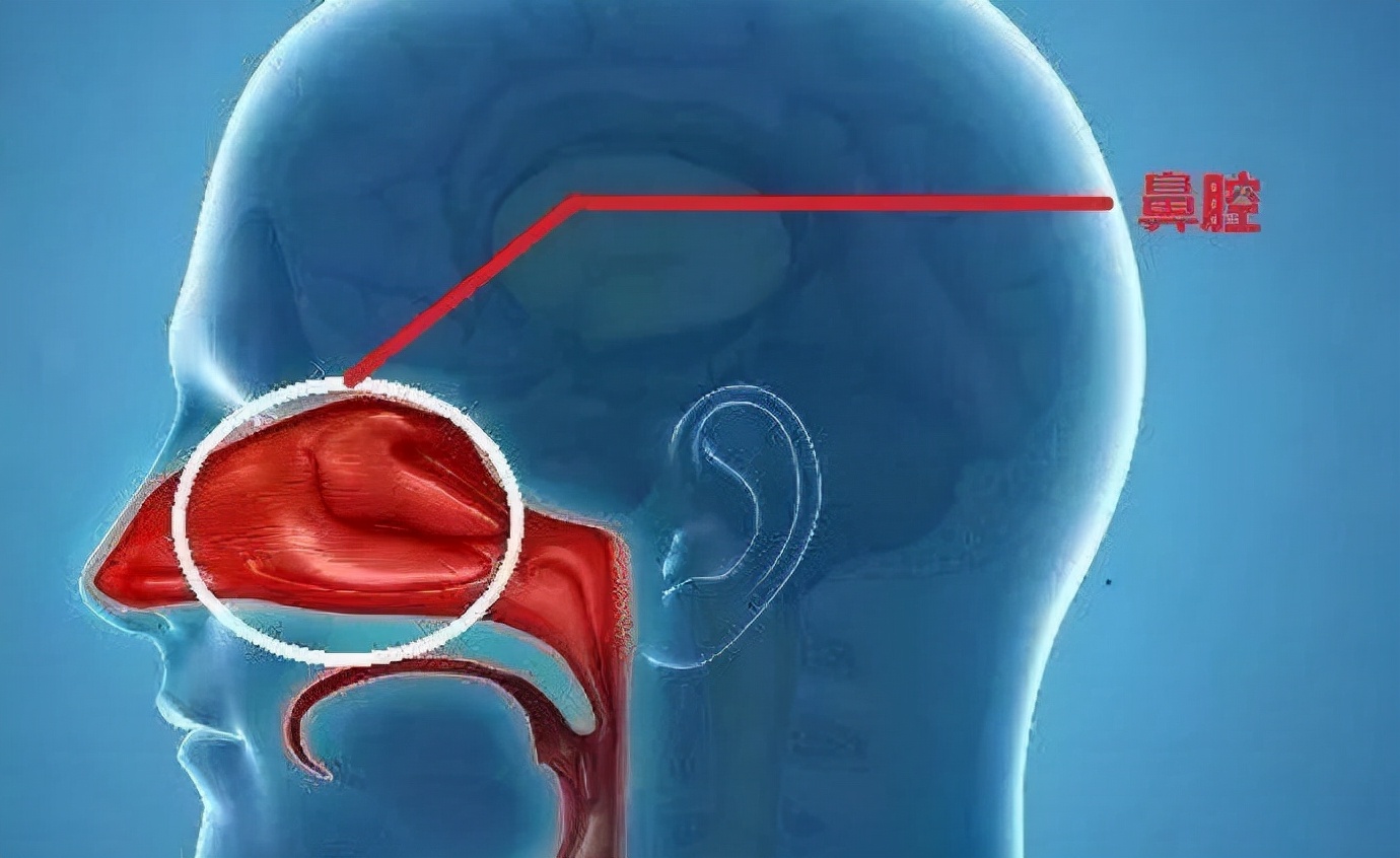 一般性头痛看什么科室,不明头痛是怎么回事