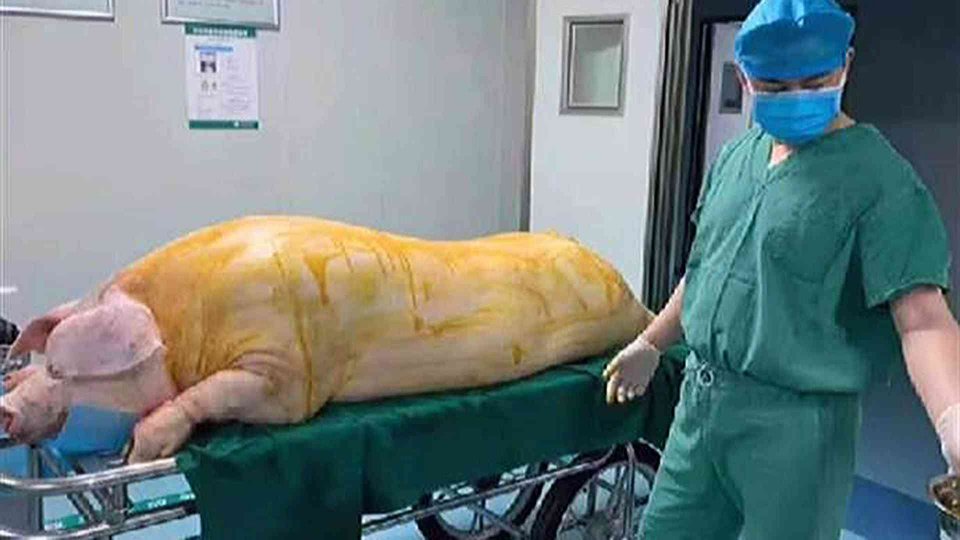 8岁女孩罕见怪病后续,8岁女孩罕见怪病