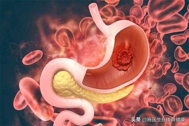 烧心反酸打嗝胀气吃什么食物缓解,胃疼反酸水烧心打嗝怎么快速缓解