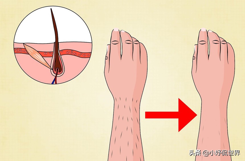 女性脱毛骗局,来看看脱毛误区你中了几个