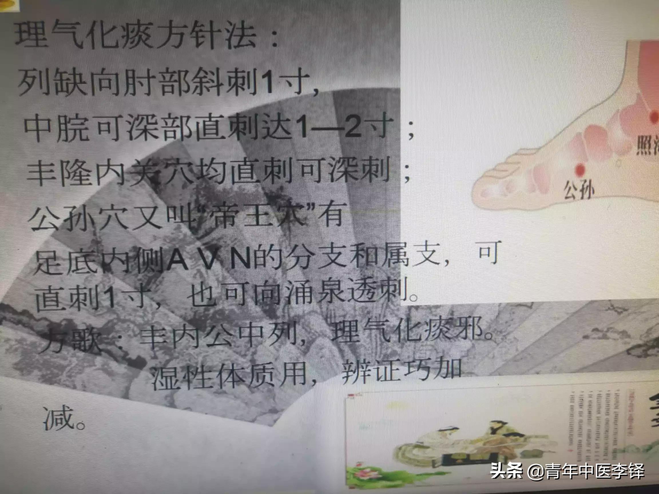 关于“针灸戒毒”技术的操作规范