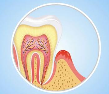 孩子有牙痛的症状怎么办,孩子牙痛解决方法