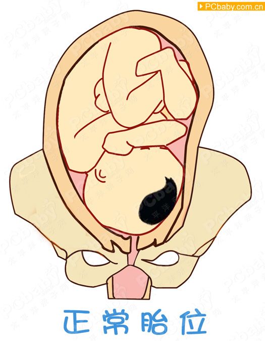 39周胎位不正能转过来吗,胎位不正怎么转胎位图解