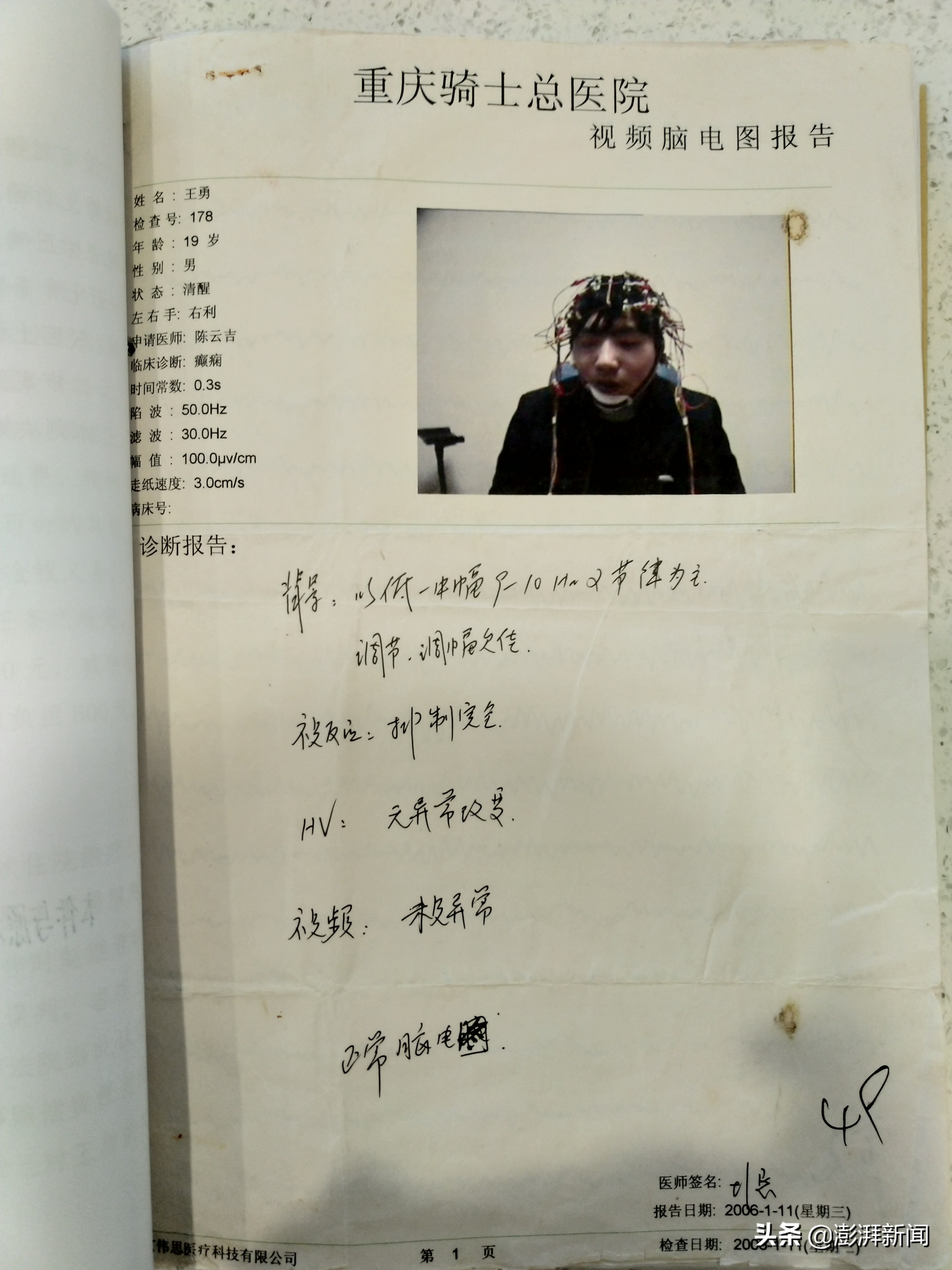 癫痫病人发作死亡,29岁癫痫患者突然去世