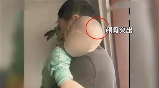 大头娃娃奶粉是谁检测出来的,大头娃娃奶粉现在怎么样了