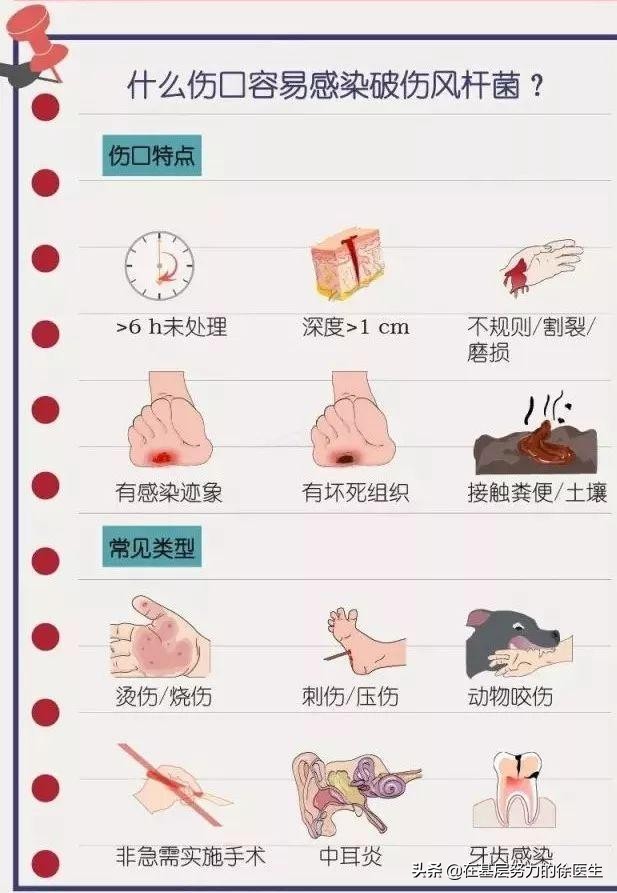 破伤风多久犯病,破伤风的潜伏期