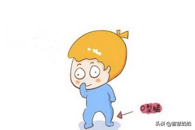 新生儿不绑腿就成O型腿？绑，还是不绑