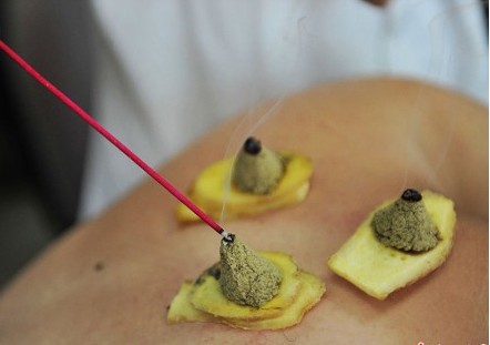 肠胃不好喝凉水都拉肚子怎么办,聚餐拉肚子怎么治