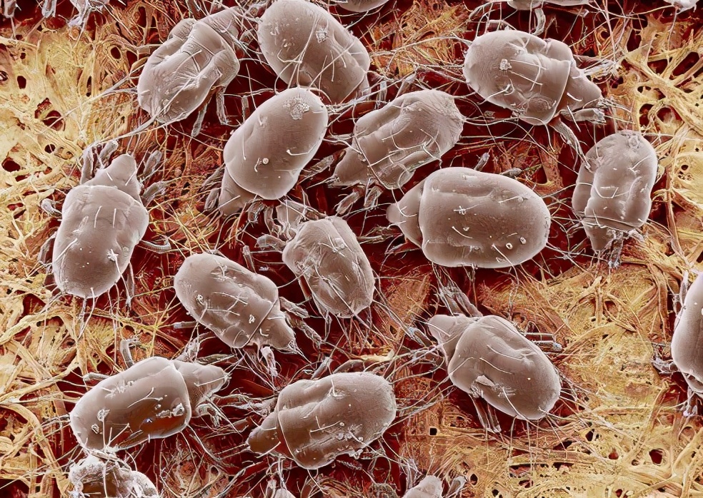 鼻子上的痘痘怎么遮住不化妆,鼻子长痘化妆快速消除