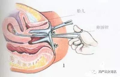 告诉你一个冰冷而残酷的真相,今天我要告诉你一件事