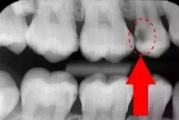 看牙不拍片直接说费用,医院看牙拍片贵吗