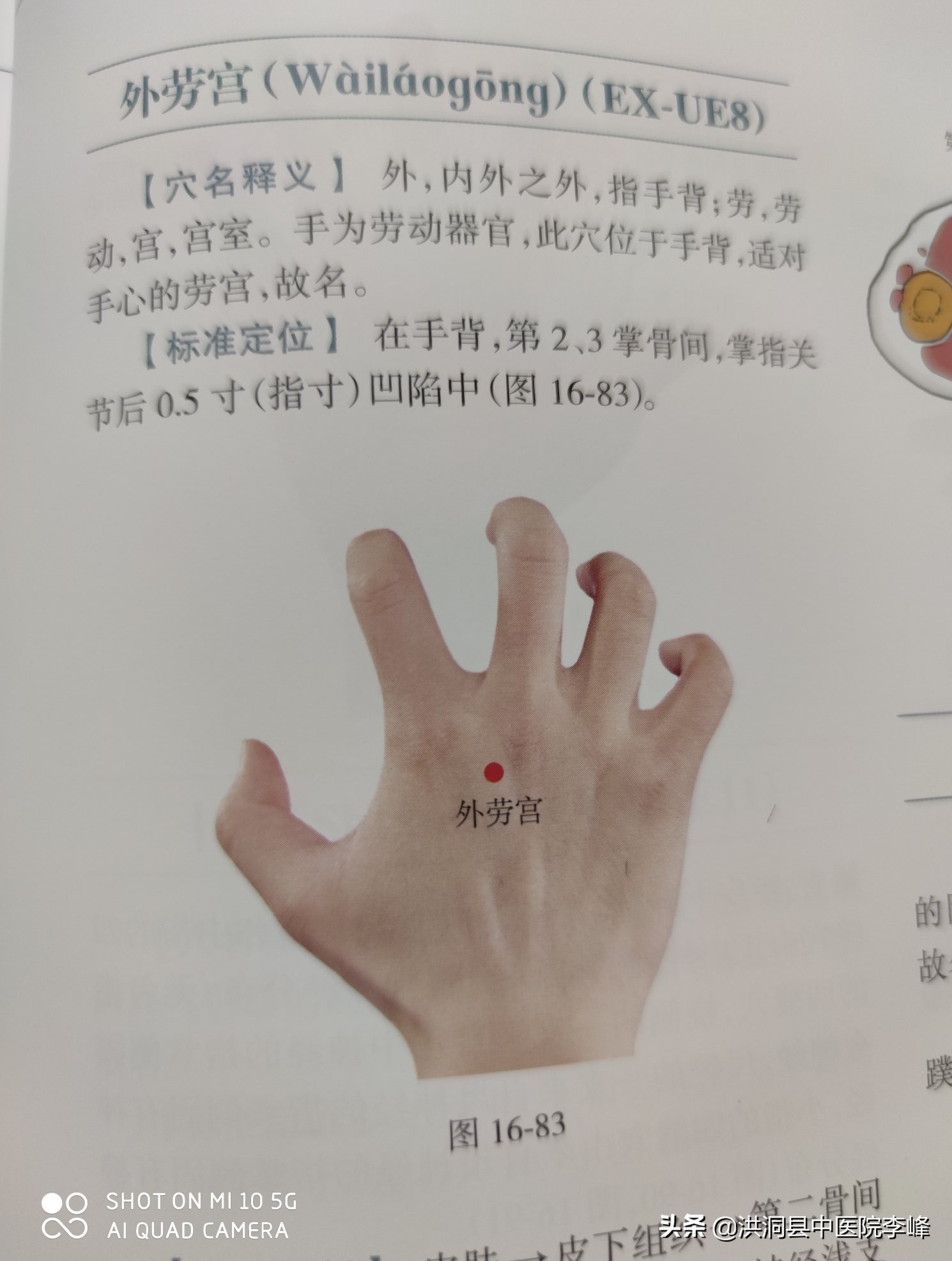 常见痛症“针刺运动疗法”特定取穴