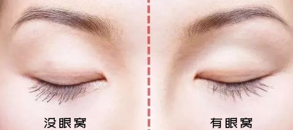 肿眼泡千万不要这么画眼妆,肿眼泡怎样画眼妆