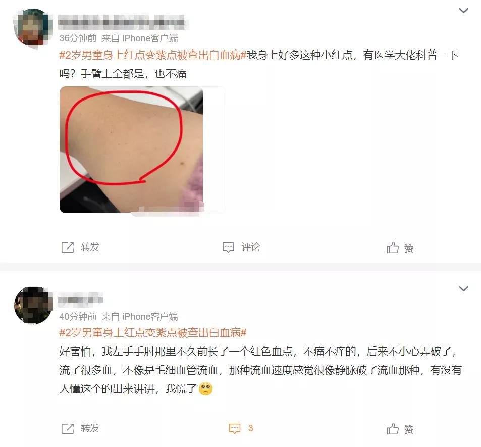 两岁宝宝发烧身上有红疹子,小宝38度发烧身上起红点怎么回事